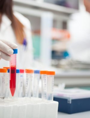 Kanser tedavisinde immünoterapi dönemi!