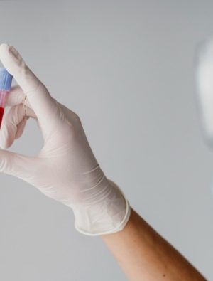 Nadir hastalık olan Hemofili nedir?