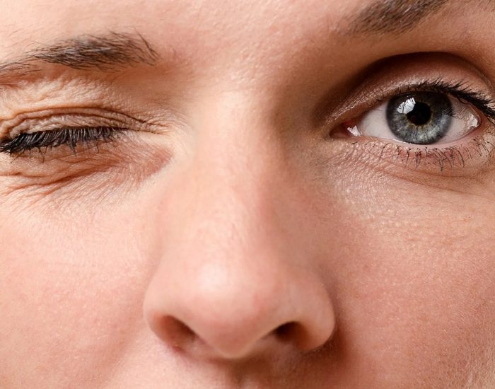 Göz seğirmesi masum mu? Hastalık habercisi mi?