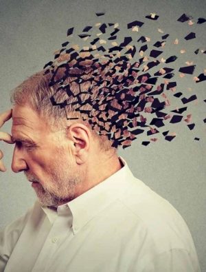 Bu hastalıkta beyindeki değişim 20 yıl önce başlıyor!